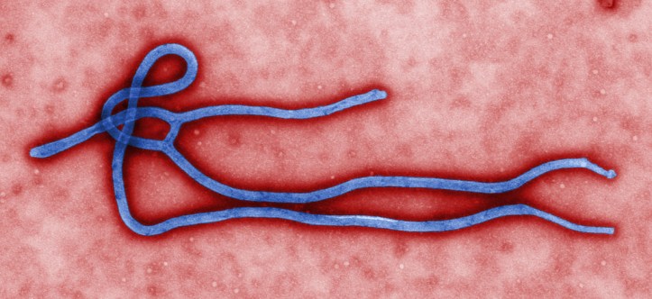 L'OMS enquête actuellement sur des dérives liés à la gestion de la maladie à virus Ébola en RD Congo Crédit photo: virus Ebola, CDC Global